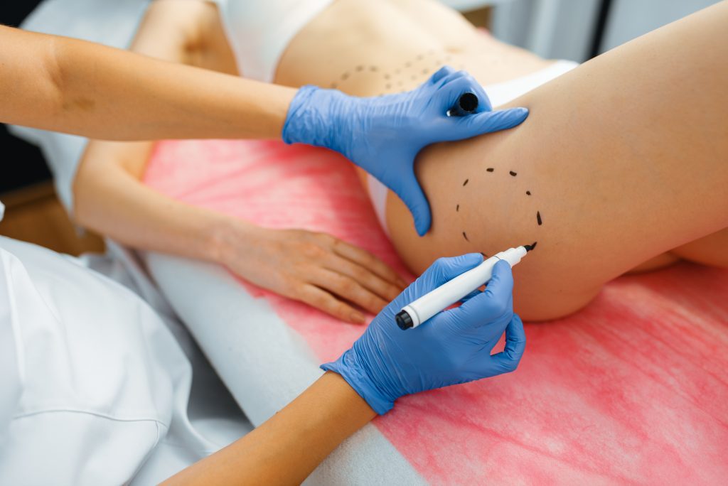 Cuánto cuesta una lipotransferencia en España