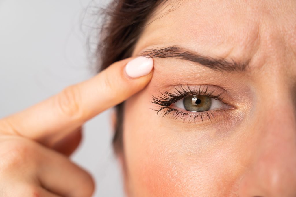 Cuánto cuesta una blefaroplastia en España