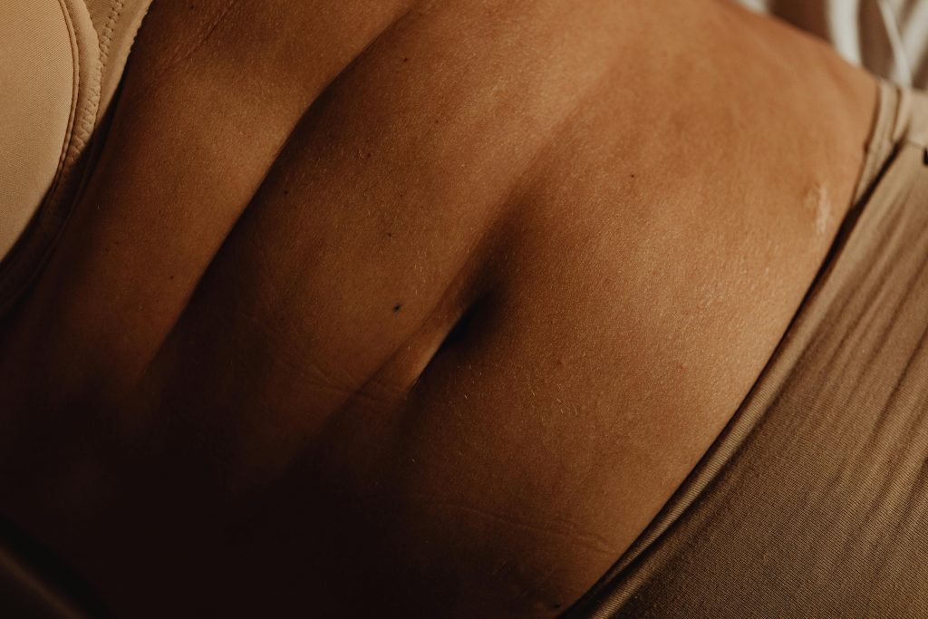 Me hice una abdominoplastia y tengo barriga