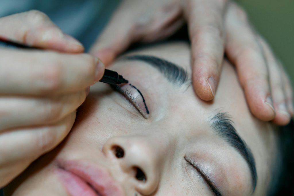 Resultados en Madrid de blefaroplastia sin cirugía
