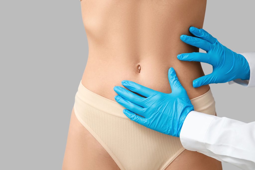 Lipo HD y Marcaje Abdominal_ Esculpir la silueta para el verano