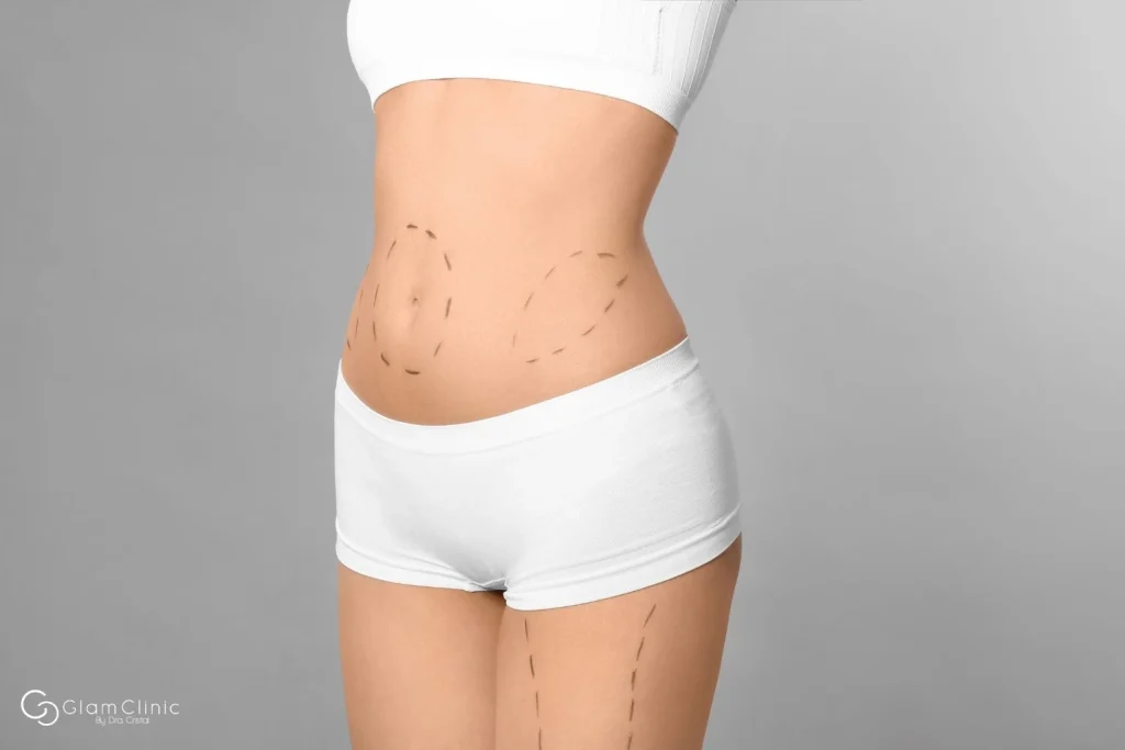 Abdominoplastia y liposucción Madrid